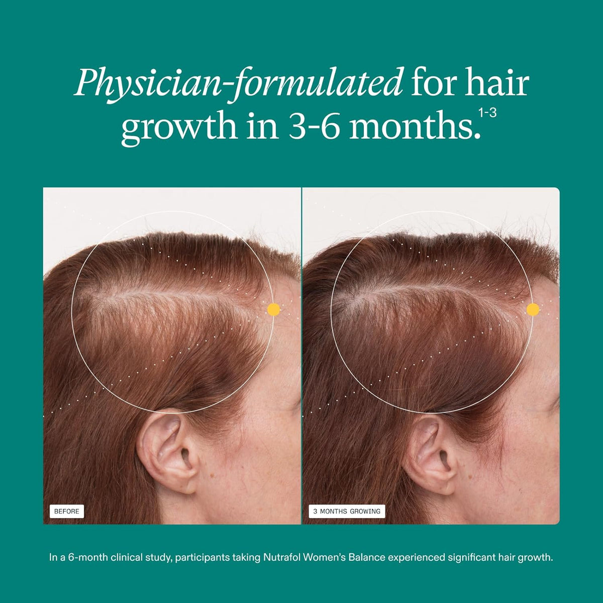 Nutrafol Women's Balance Hair Growth Supplements 120 Capsules.