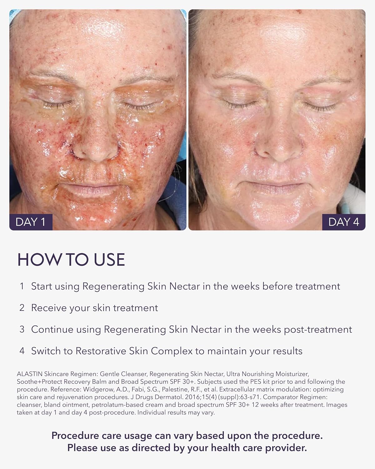 ALASTIN Skincare Regenerating Skin Nectar Face Moisturizer (1 oz) | Hydrating Serum Designed to Maximize Procedure Results, Soothe Skin and Reduce Recovery Time, Suitable for Sensitive Skin