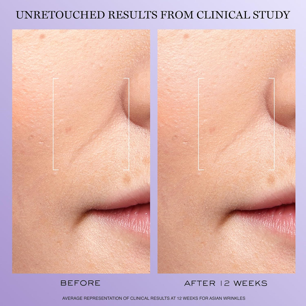 Lancôme Rénergie H.C.F. Triple Serum - Hyaluronic Acid Anti Aging Serum