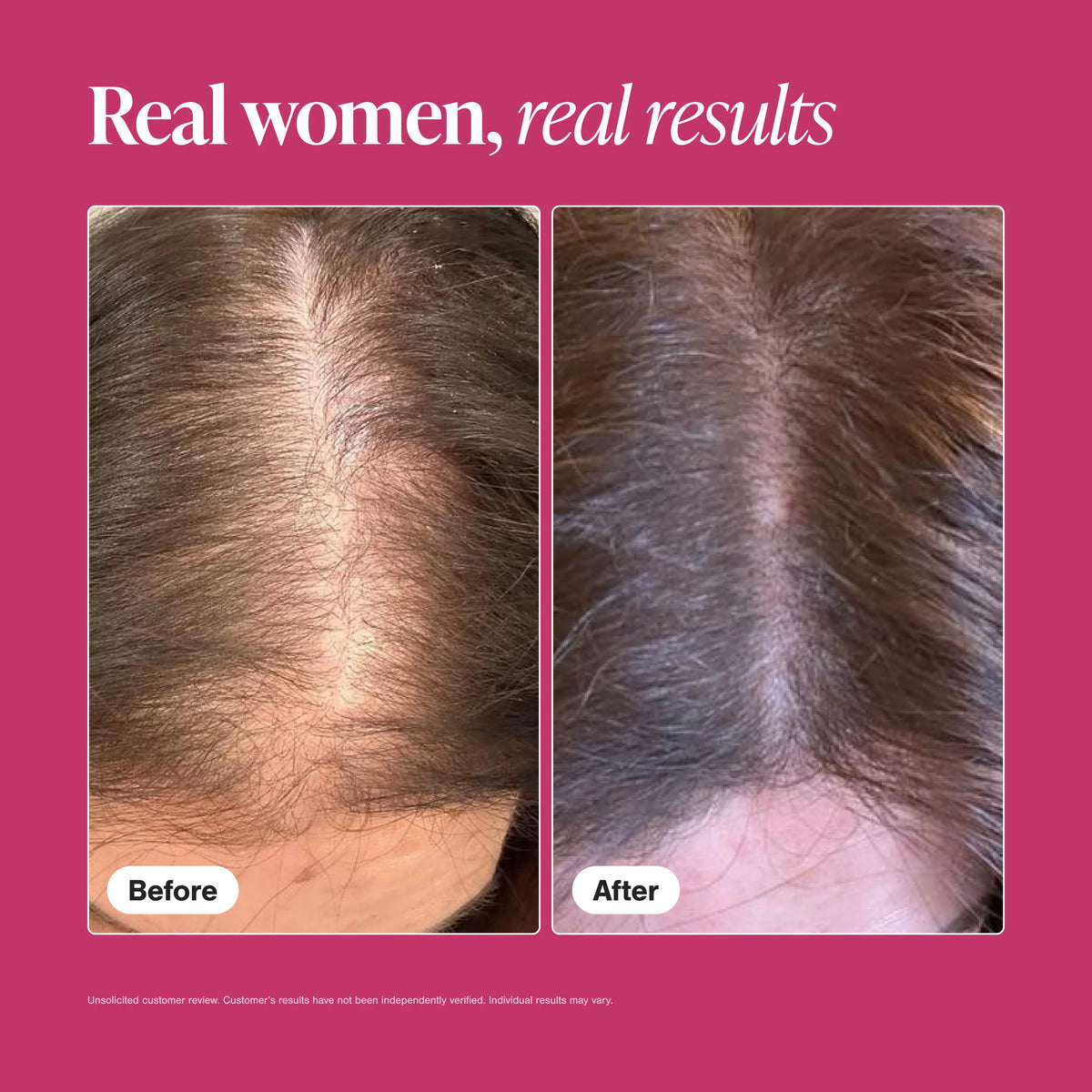 Viviscal Hair Growth Supplements